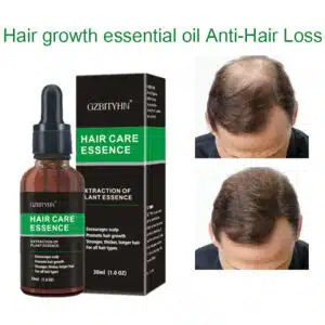 زيت نمو الشعر زيت نمو الشعر زيت أساسي للعناية بالشعر من شركة OEM
Hair Growth Oil Hair Growth Oil Oem Hair Care Essential Oil